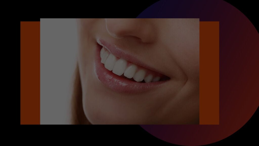 Brighten Your Smile with Teeth Whitening in Kolkata:Experts Tips 2023