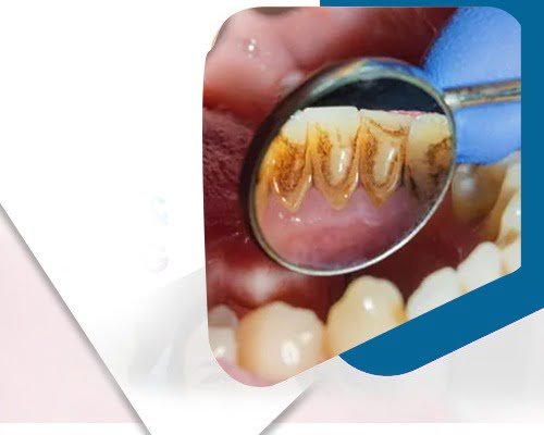 WhatsApp Image 2023-12-12 at 5.50.24 PM (1)